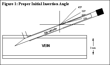 IV insertion angle proper