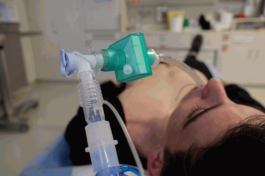 intubation allergic reaction